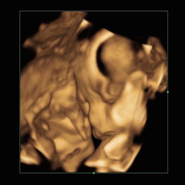 Marcella Daryanani Melahirkan Anak Pertama, Ini 6 Potret Perjalanan Kehamilannya