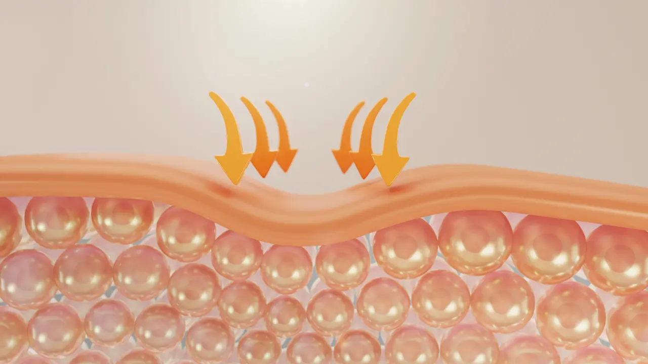 Skin barrier sebagai lapisan pelindung pertama pada kulit