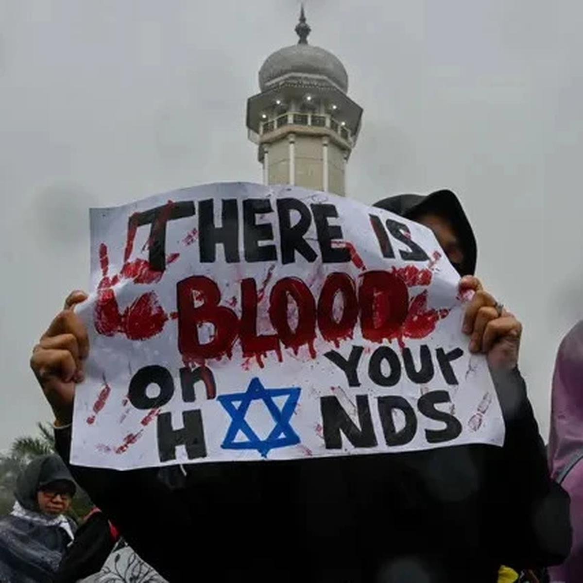 Startup Pakistan Kirim Kaki Prostetik untuk Anak Gaza Korban Serangan Israel
