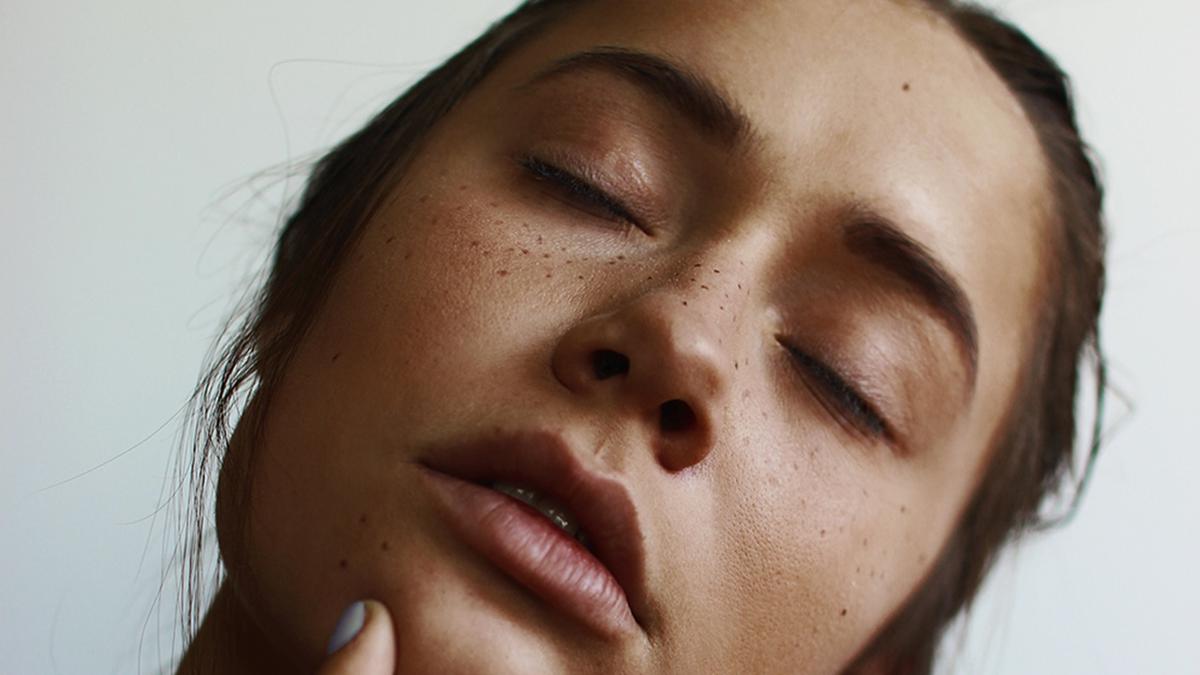 Jangan Salah! Ini Perbedaan Heat Acne vs Acne Biasa: Cara Membedakan dan Menanganinya dengan Tepat