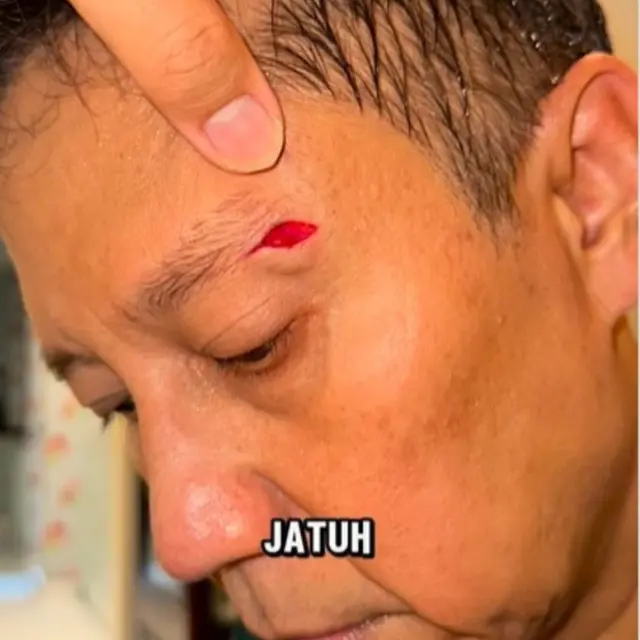 Menkes Budi Gunadi Sadikin Jatuh di Kamar Mandi, Ungkap Soal Hutang dan Khawatir Kena Stroke Ringan.  foto: Instagram @budigsadikin, @bgsadikin