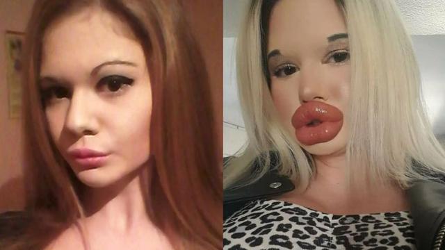 Ivanova wanita Bulgaria kecanduan operasi plastik
