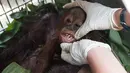 Bayi orangutan mendapat pengobatan dari tim International Animal Rescue di desa Kuala Satong, Kalimantan Barat (10/11). Orangutan dan bayinya melarikan diri dari amukan api yang menghancurkan habitatnya. (AFP PHOTO/Dailymail)