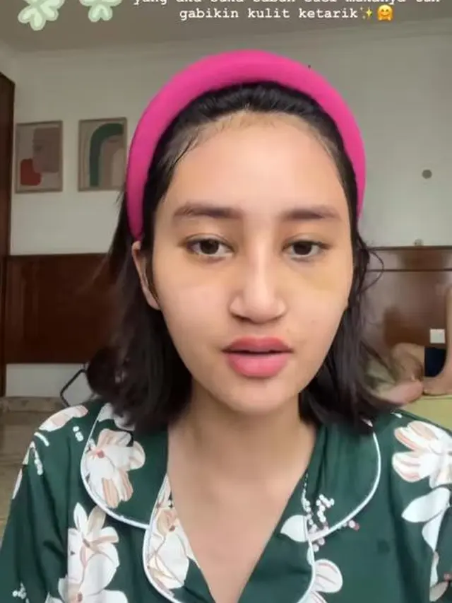 6 Potret Terbaru Permesta Dhyaz Anak Farida Nurhan Usai Oplas, Perubahannya Drastis