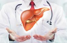 Kenali Tanda-Tanda dan Gejala Penyakit Liver, Jangan Diabaikan