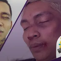 Tak lama setelah Young Lex dikabarkan mengalami pengeroyokan oleh fans Kpop di acara Meet and Greet Lisa BLACKPINK berbagai bukti pun satu-persatu mulai mencuat.