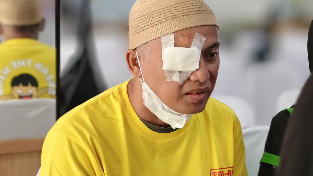 Sido Muncul gelar operasi katarak gratis