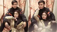 6 Prewedding Terbaru Felicya Angelista dan Caesar Hito, Posenya Jadi Sorotan