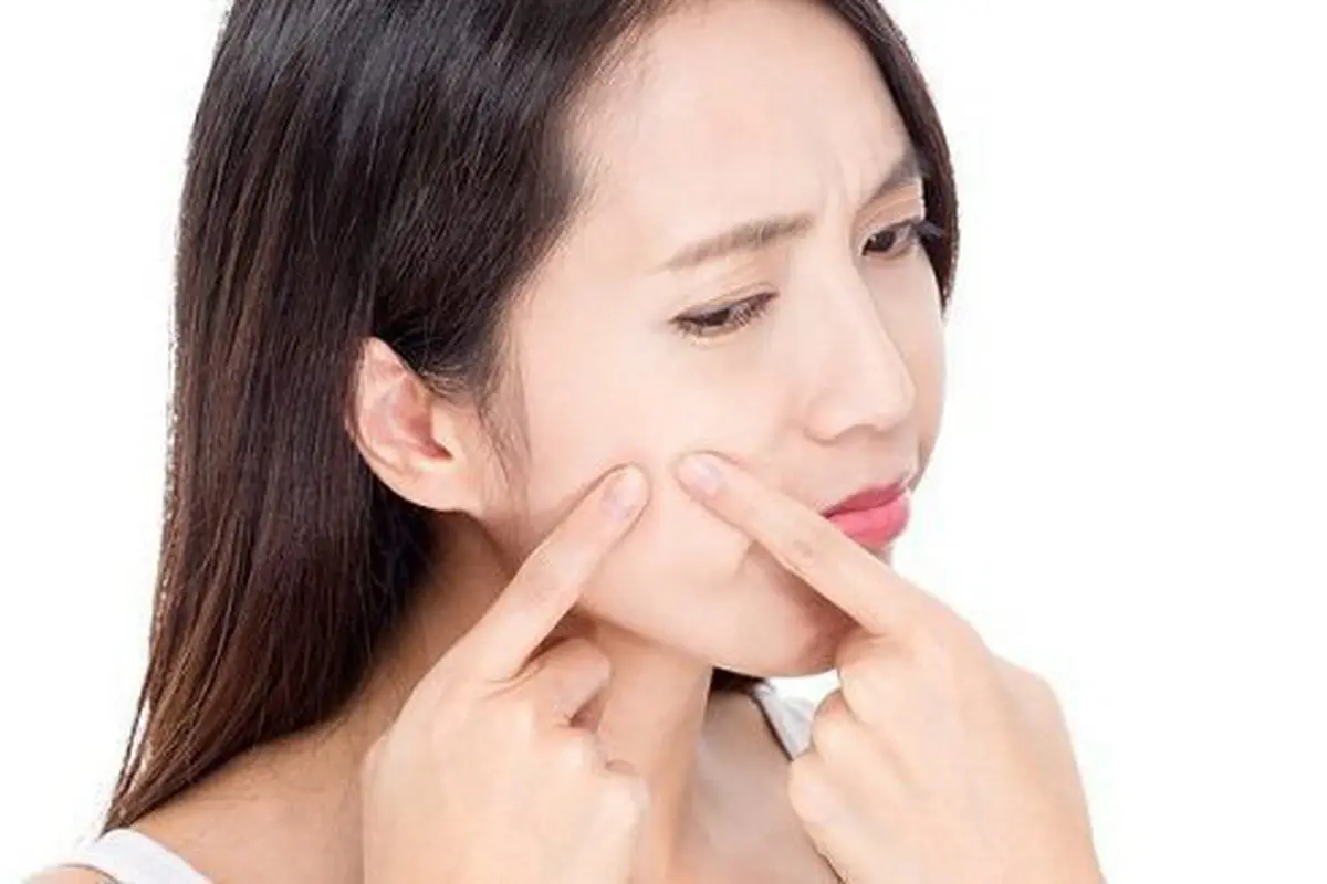 Jangan takut bermake up meskipun berjerawat/copyright: thinkstockphotos.com
