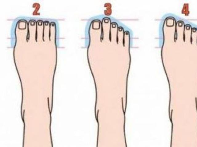 7 Macam Kepribadian Dari Bentuk Kaki Kamu Yang Mana Citizen6 Liputan6 Com