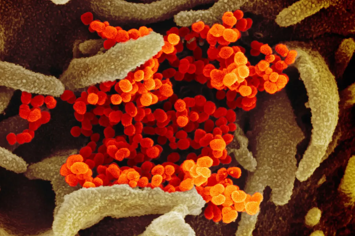 Virus Corona COVID-19 dari Mikroskop
