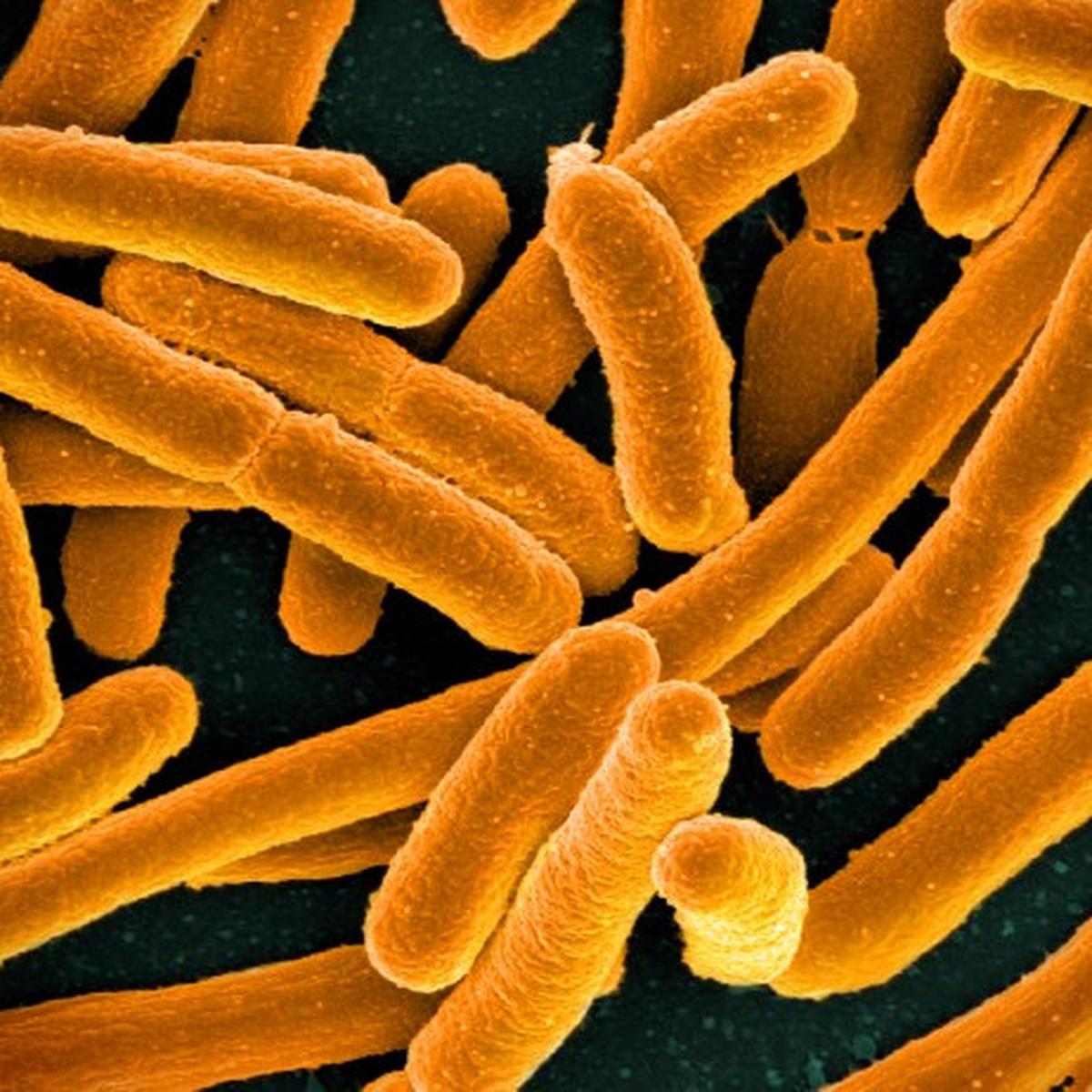 bakteri e.coli