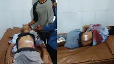 Pelajar SMA Lampung Duel dengan Begal, Tumbang Diterjang Peluru Menembus Perut