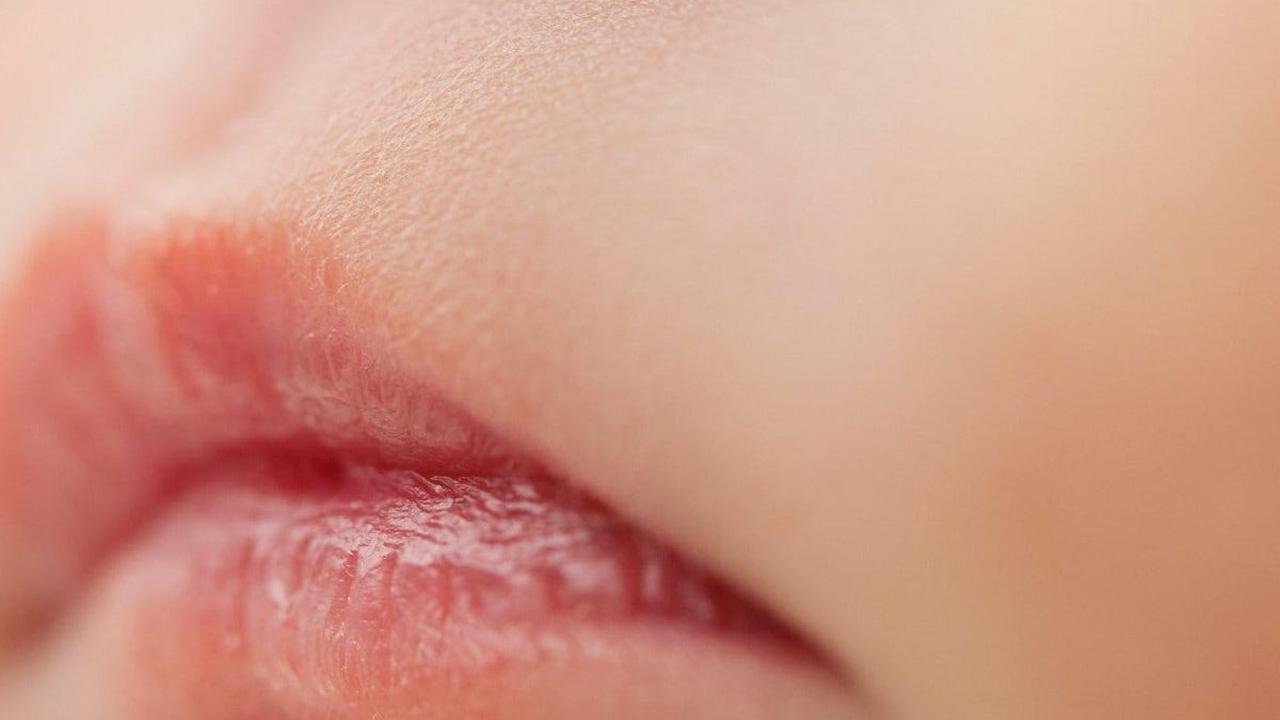 Penyebab Bibir Kering pada Anak, Begini Cara Mengatasinya