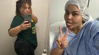 Kesulitan Diet, Wanita Ini Ternyata Derita Tumor Ovarium yang Tak Biasa