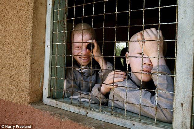 Anak dan orang dewasa Albino lebih suka bersembunyi agar kejahatan tidak menimpa mereka | Photo: Copyright daylimail.co.uk