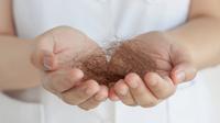 Kerontokan rambut karena Alopecia (Sumber: iStockphoto)