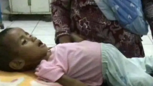 Kisah Pilu Para Penderita Gizi Buruk