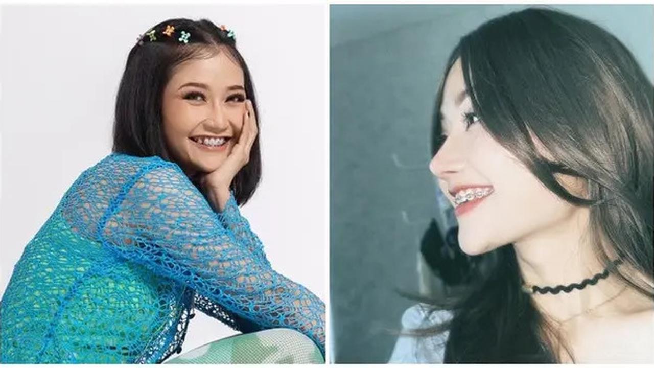 6 Potret Riyuka Bunga Sebelum dan Sesudah Oplas Hidung, Dulu Dipanggil Pesek