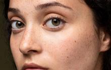 Cara Mengatasi Flek Hitam di Wajah dengan AHA Alami, Tak Perlu Beli Serum