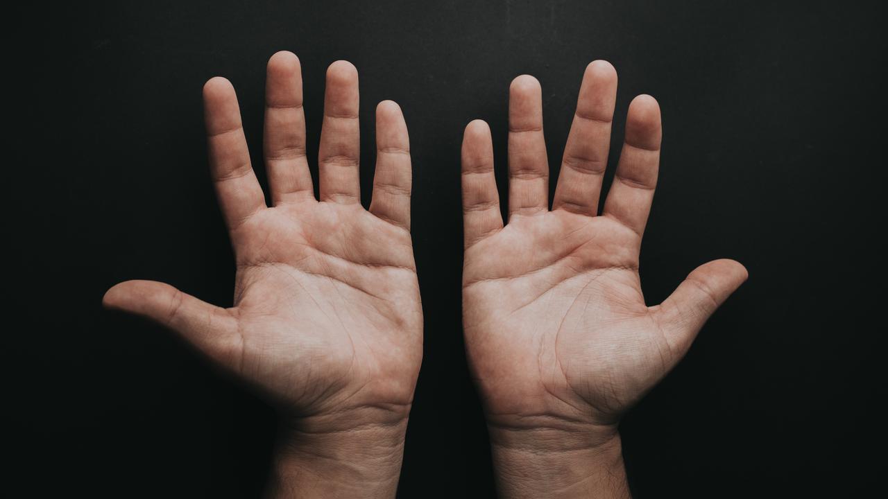 Penyebab Telapak Tangan Berkeringat dan Cara Mengatasinya dengan Bahan Alami