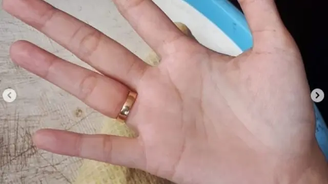 Pelepasan cincin