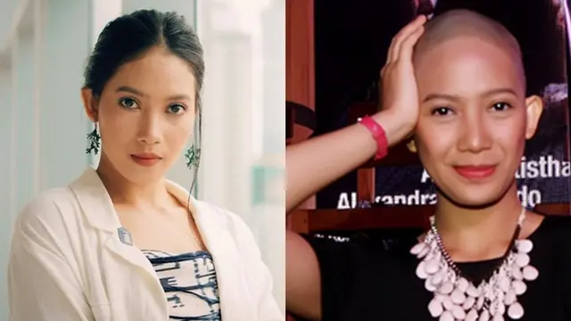 Selain Megan Domani, 6 Aktris Ini Totalitas Tampil Botak Demi Peran