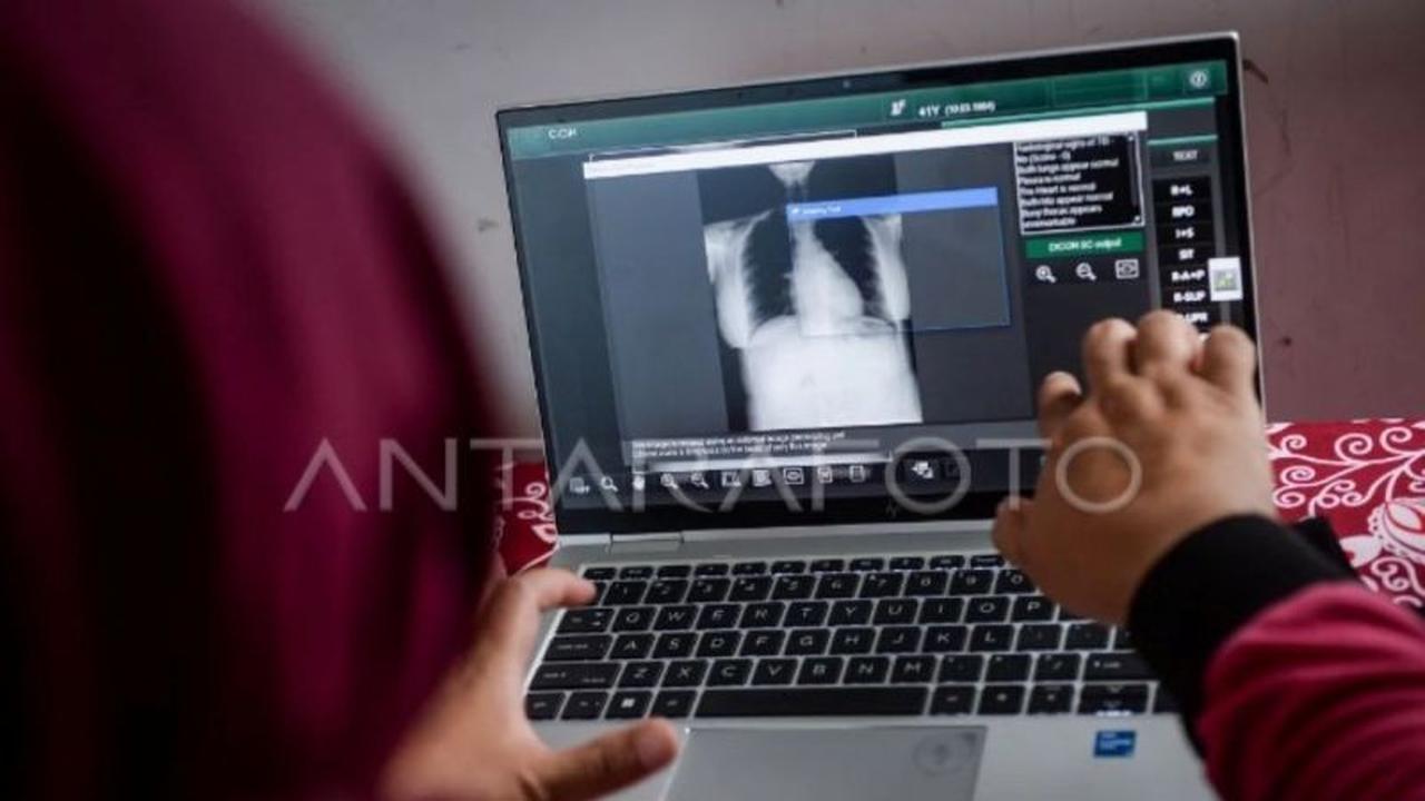 Kementerian Kesehatan Tingkatkan Anggaran untuk Percepatan Deteksi TBC di 2026