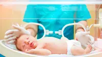 Skrining yang Perlu Dilakukan pada Bayi Prematur (Olesia Bilkei/Shutterstock)