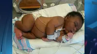 Inilah Avery John, si bayi yang lahir dengan berat 7 kilogram. (Photo: St. Joseph’s Women’s Hospital from www.wfla.com)