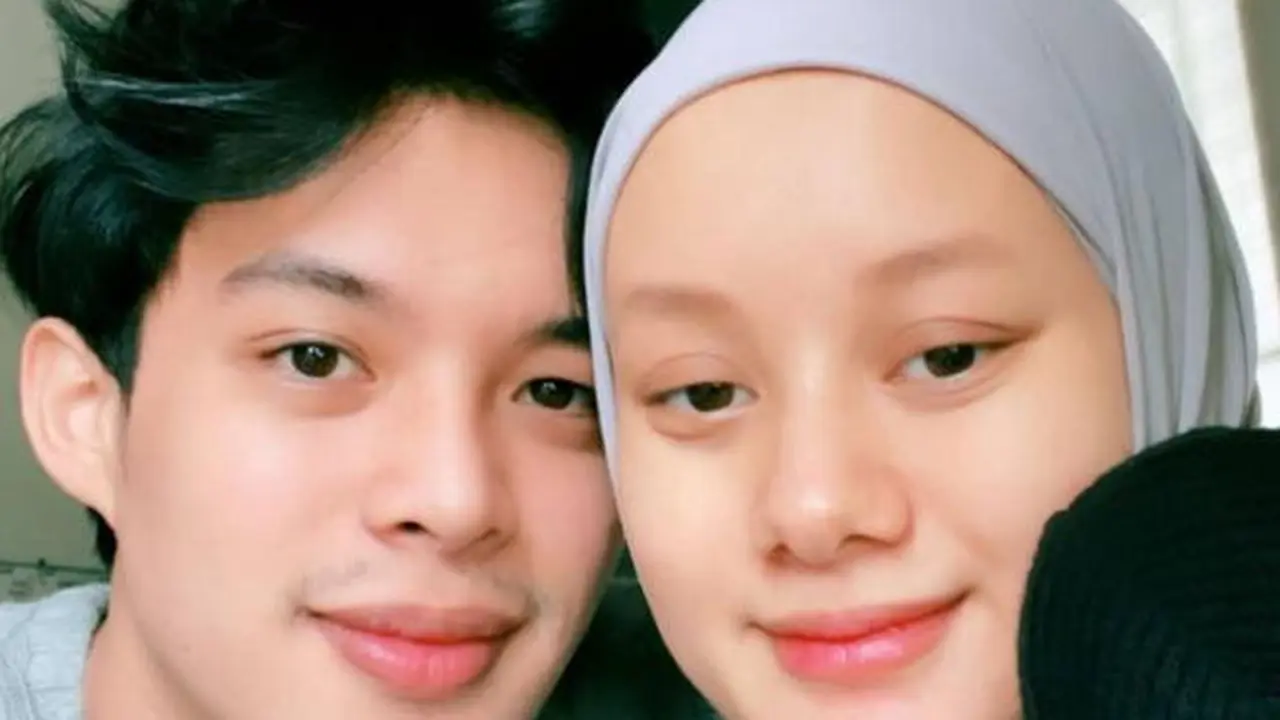 Potret Wajah Dinda Hauw Tanpa Makeup, Bantah Rumor Oplas