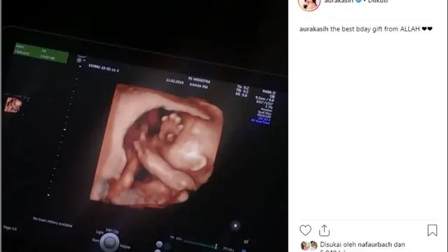 Aura Kasih (Foto: Instagram)