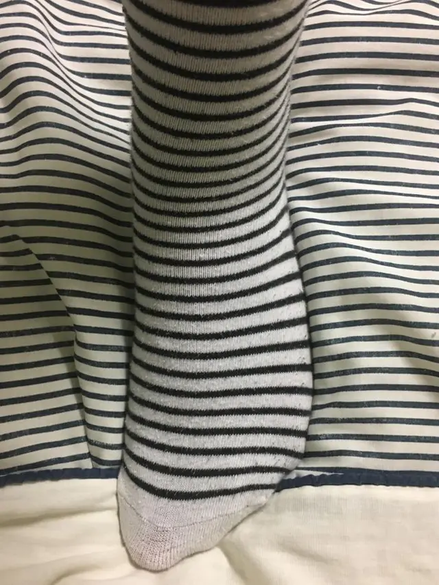 8 Potret Benda Ini Mirip dengan Lingkungan Sekitar, Bak Kamuflase