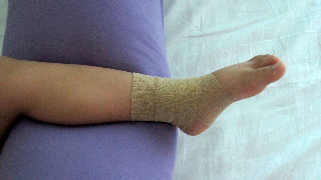 Waspada, Ini Mainan Anak Paling Sering Sebabkan Kecelakaan