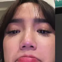 Fuji mengidap skoliosis. Kenali penyebab dan gejalanya berikut ini. [Instagram/fuji_an].