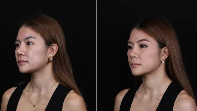 Cantik Alami di Setiap Usia, Yuk Saatnya Sayangi Kulit dengan Perawatan yang Tepat!