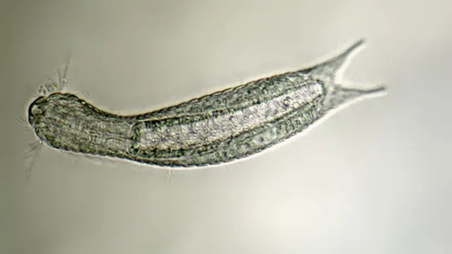 Gastrotricha (Wikipedia/Creative Commons)