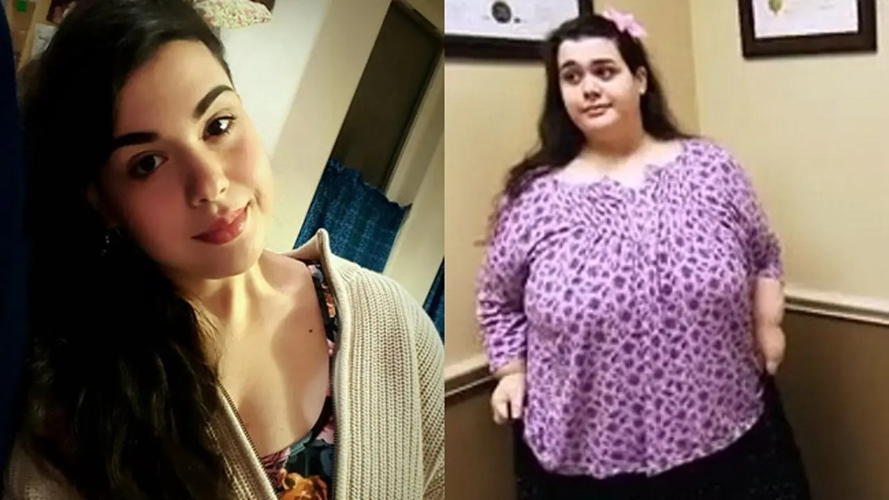 [Bintang] Kurus