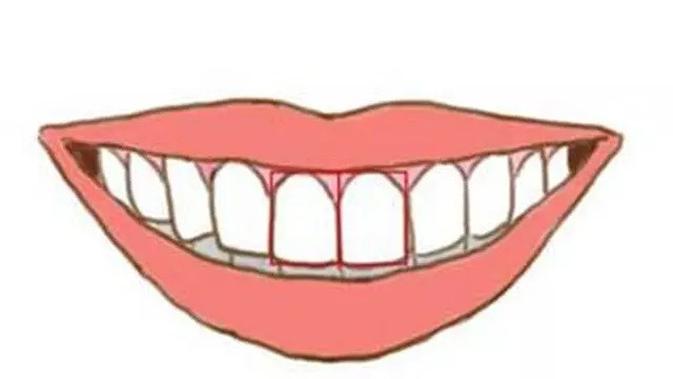 Ilustrasi gigi depan (Sumber: Lols.me)