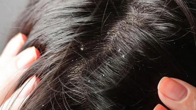Ini Cara Jitu Atasi Rambut Berbagai Tipe