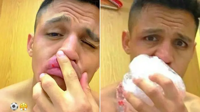 Alexis Sanchez, pemain Arsenal mengunggah foto di Instagram