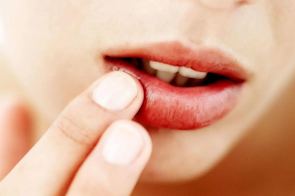 Ilustrasi bibir.