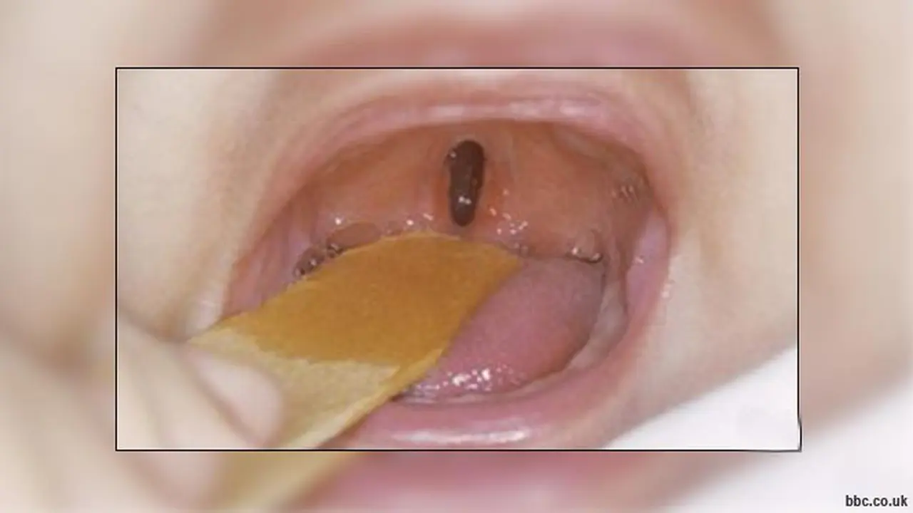bibir-sumbing121214b.jpg