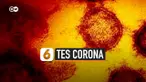 tes corona