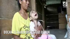 Seorang bocah 15 tahun di Sulawesi Barat hanya memiliki berat badan 6,7 kilogram.