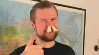Peter von Tangen Buskov, pria asal Denmark yang berhasil memasukkan 68 korek api ke lubang hidungnya. (Dok. Guinness World Records)