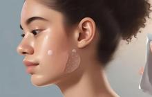 Banyak Gen Z Gunakan Acne Patch untuk Jerawat, Ketahui Efek Samping yang Bisa Ditimbulkannya