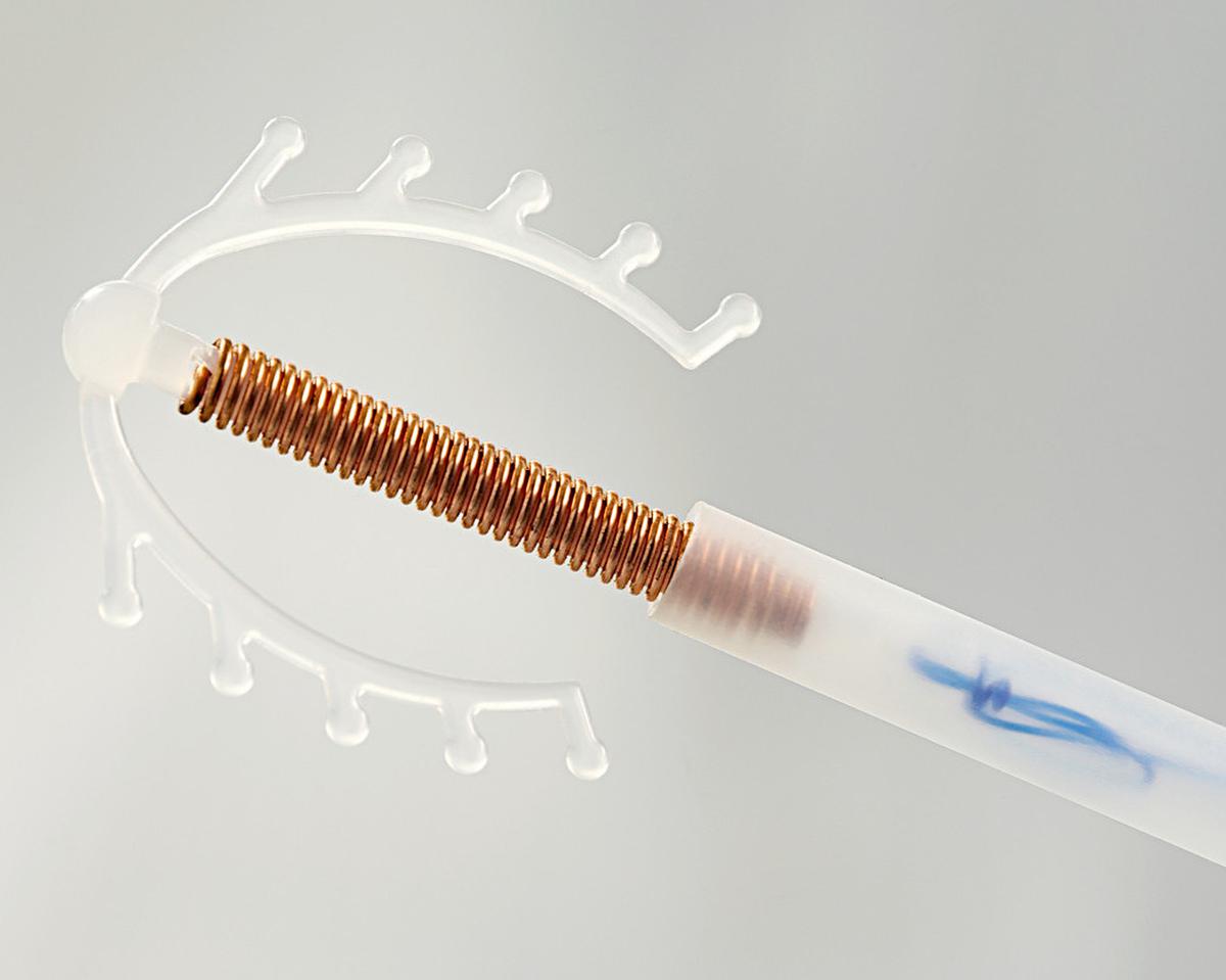 Alat KB IUD (iStock)