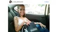 Tubuh Penuh Tahi Lalat, Wanita Ini Tak Minder Jadi Miss Universe