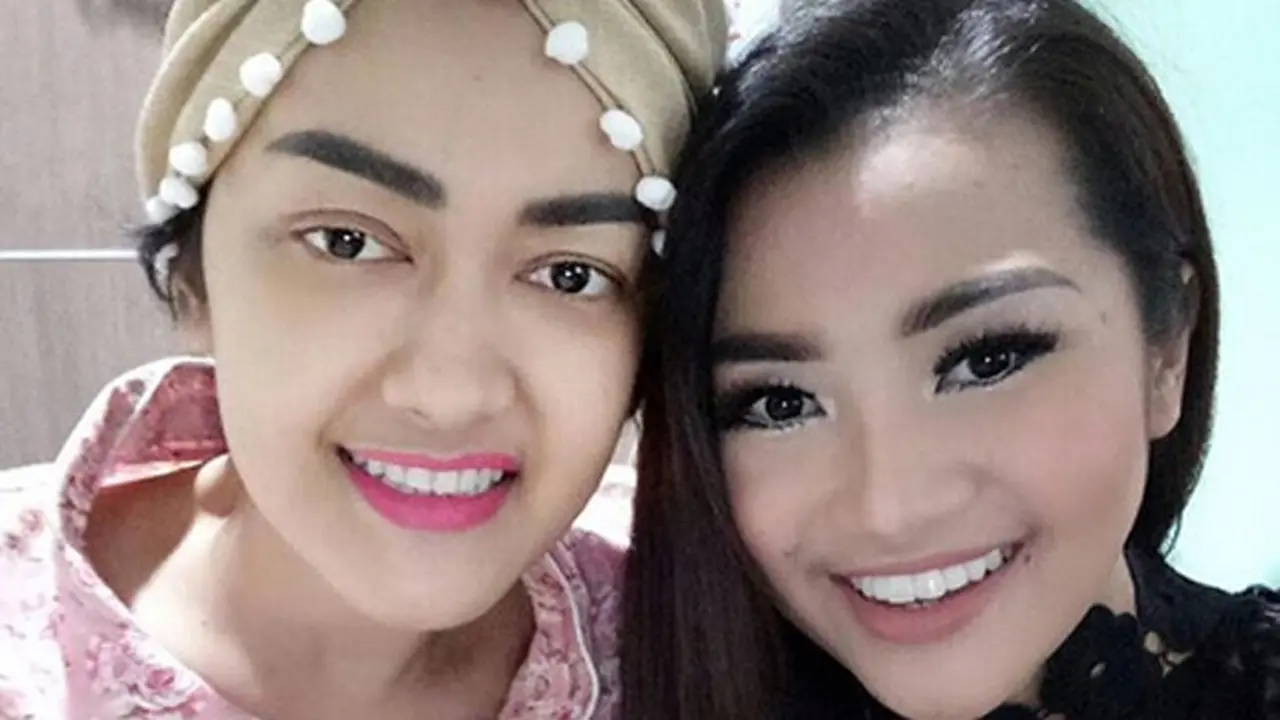 [Bintang] Fitri Carlina di RSCM
